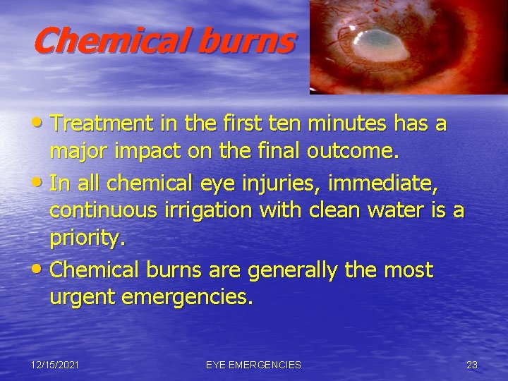 Chemical burns • Treatment in the first ten minutes has a major impact on