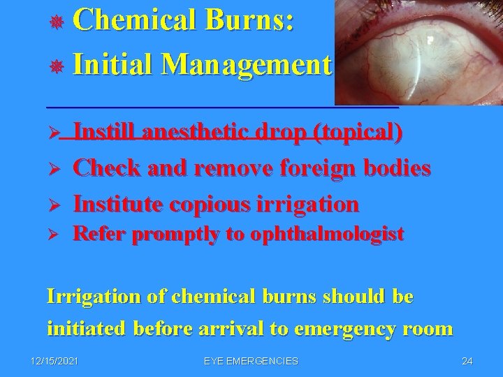 ¯ Chemical Burns: ¯ Initial Management __________________ Ø Instill anesthetic drop (topical) Check and