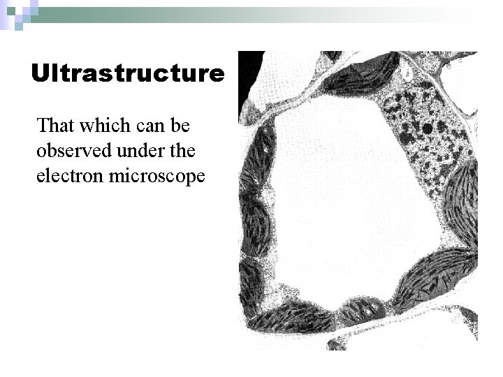 Ultrastructure That which can be observed under the electron microscope 