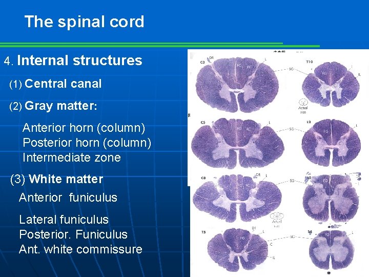 The spinal cord 4. Internal structures (1) Central (2) Gray canal matter: Anterior horn