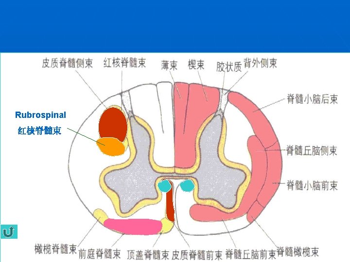 Rubrospinal 红核脊髓束 