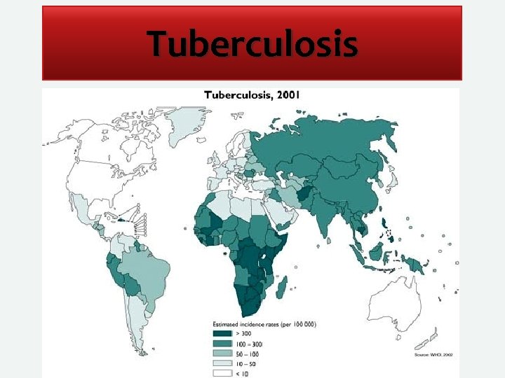 Tuberculosis 