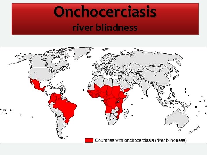 Onchocerciasis river blindness 