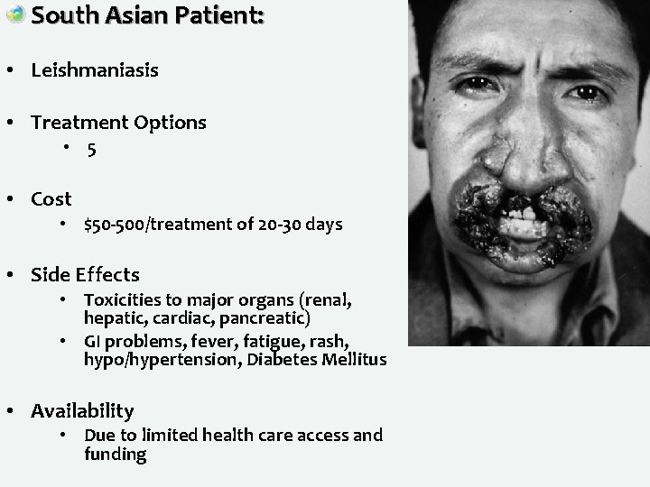South Asian Patient: • Leishmaniasis • Treatment Options • 5 • Cost • $50