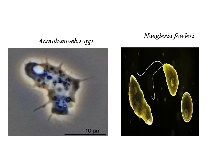 Acanthamoeba spp Naegleria fowleri 