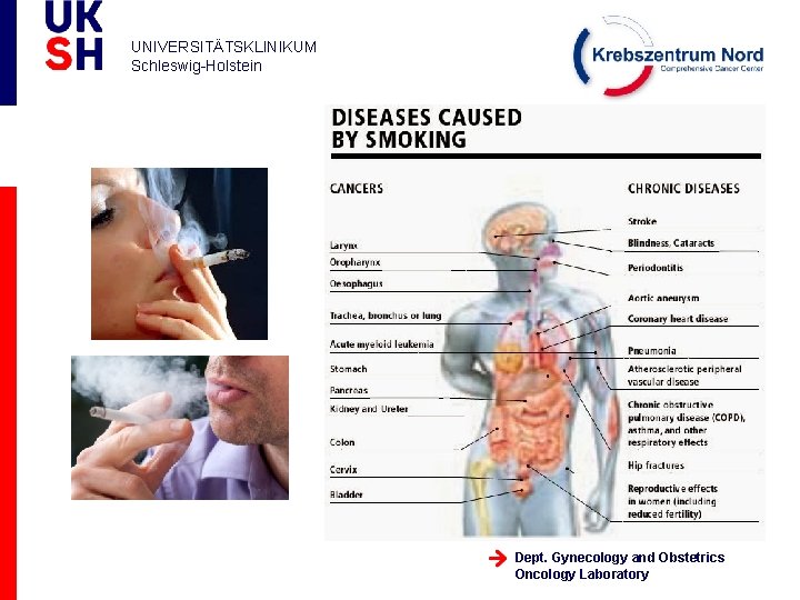 UNIVERSITÄTSKLINIKUM Schleswig-Holstein Dept. Gynecology and Obstetrics Oncology Laboratory 