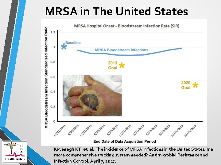 MRSA in The United States Kavanagh KT, et. al. The incidence of MRSA infections