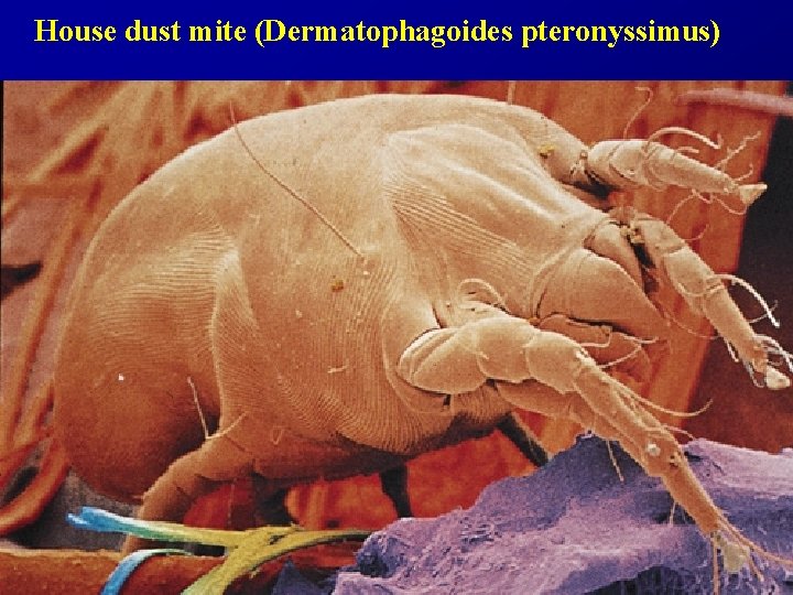 House dust mite (Dermatophagoides pteronyssimus) 