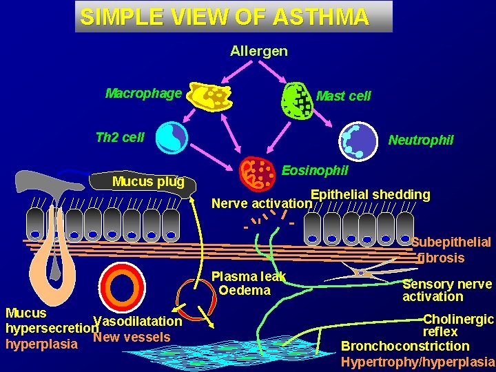 SIMPLE VIEW OF ASTHMA Allergen Macrophage Mast cell Th 2 cell Mucus plug Neutrophil