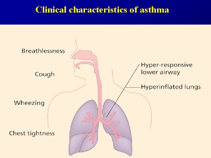 Clinical characteristics of asthma 