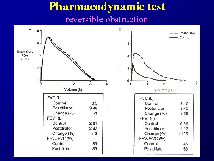 Pharmacodynamic test reversible obstruction 