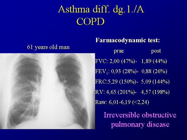 Asthma diff. dg. 1. /A COPD 61 years old man Farmacodynamic test: prae post