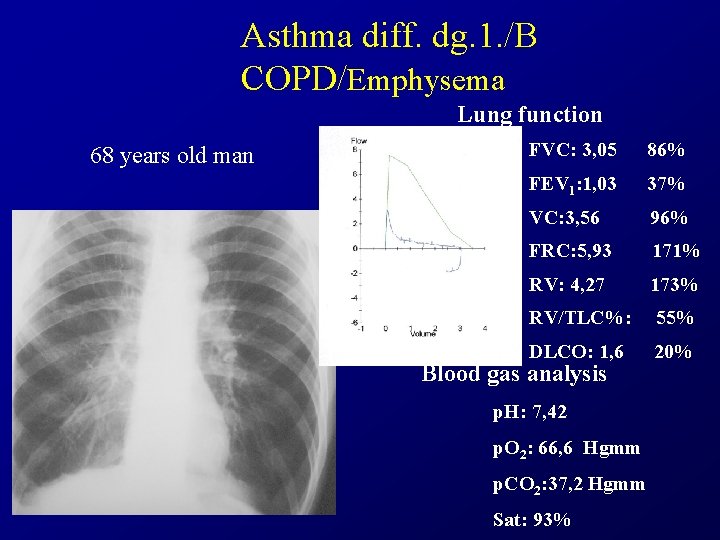 Asthma diff. dg. 1. /B COPD/Emphysema Lung function 68 years old man FVC: 3,