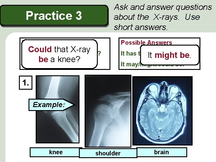 Ask and answer questions about the X-rays. Use short answers. Practice 3 Possible Questions