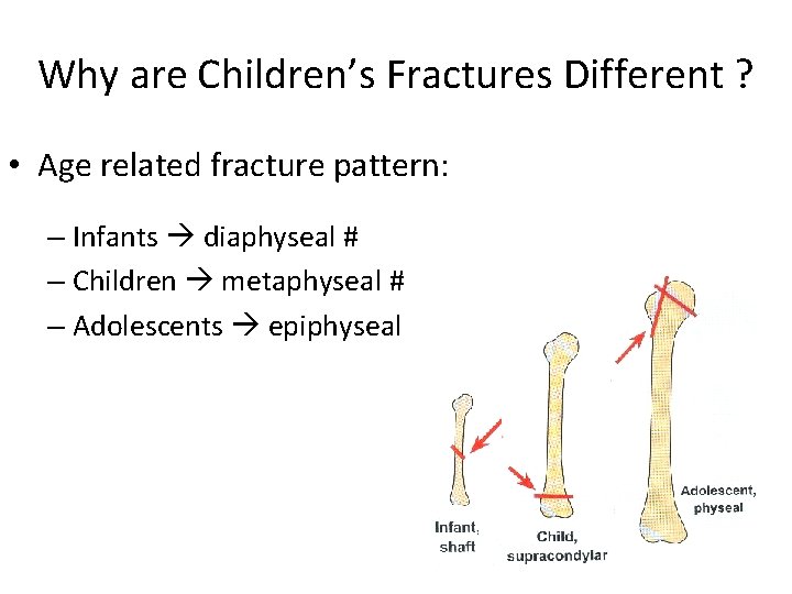 Why are Children’s Fractures Different ? • Age related fracture pattern: – Infants diaphyseal