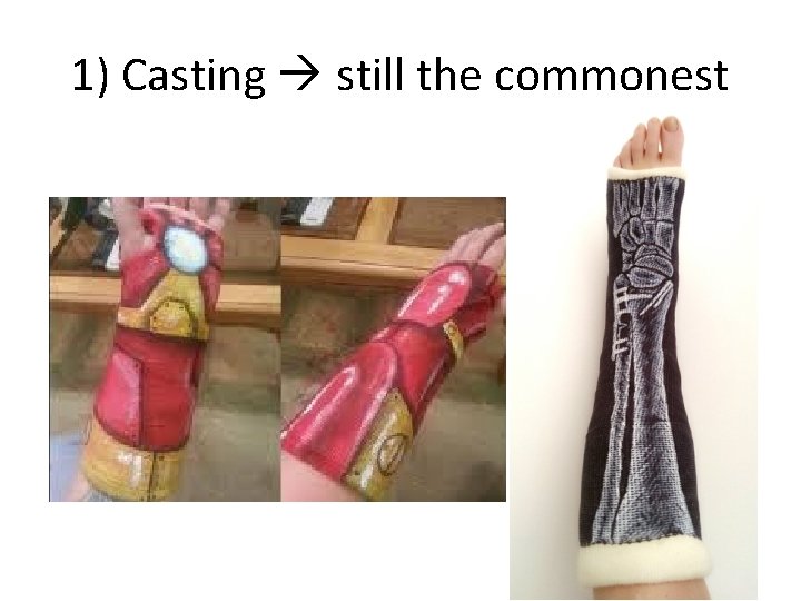 1) Casting still the commonest 