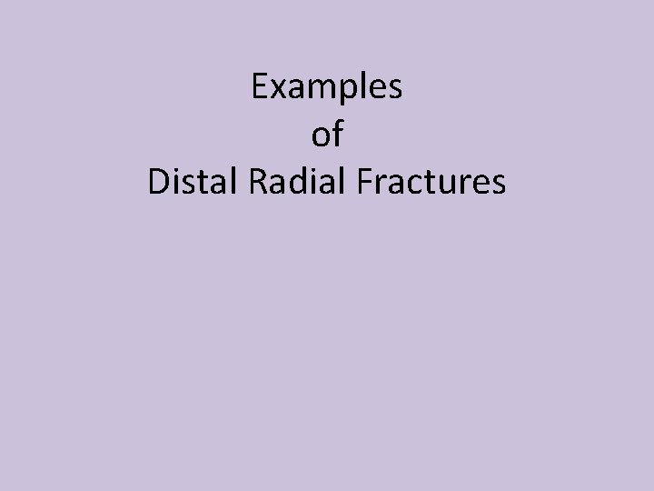 Examples of Distal Radial Fractures 