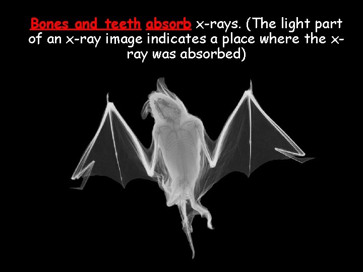 Bones and teeth absorb x-rays. (The light part of an x-ray image indicates a Bones and teeth absorb x-rays. (The light part of an x-ray image indicates a
