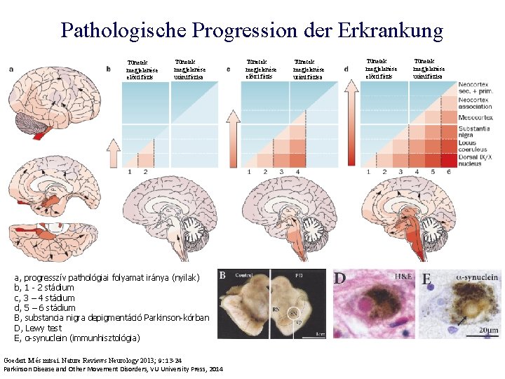 Pathologische Progression der Erkrankung Tünetek megjelenése előtti fázis Tünetek megjelenése utáni fázisa a, progresszív