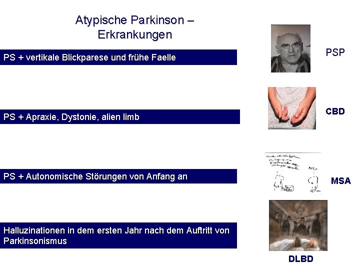 Atypische Parkinson – Erkrankungen PSP PS + vertikale Blickparese und frühe Faelle CBD PS