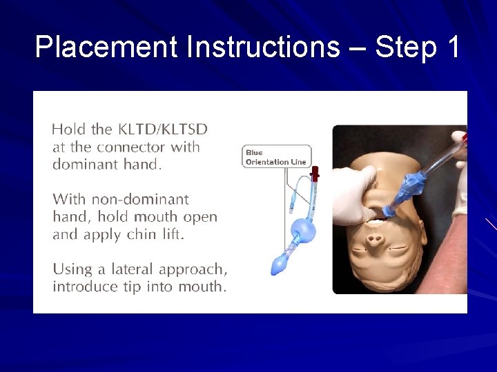 Placement Instructions – Step 1 