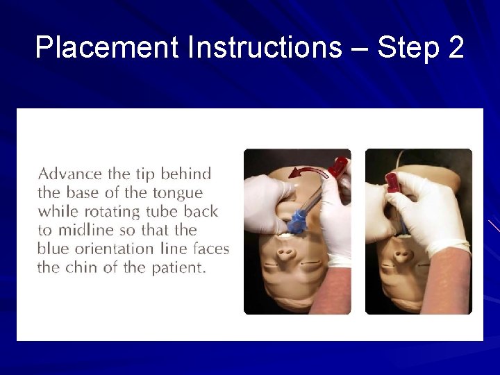 Placement Instructions – Step 2 