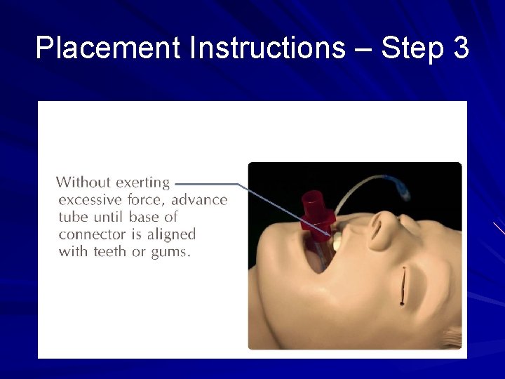Placement Instructions – Step 3 