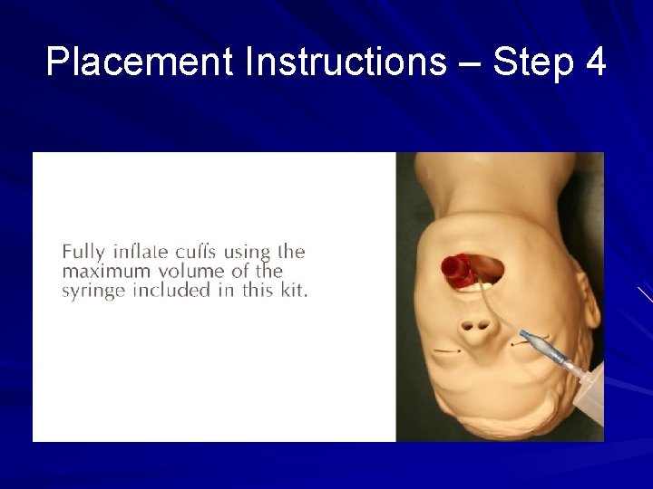 Placement Instructions – Step 4 