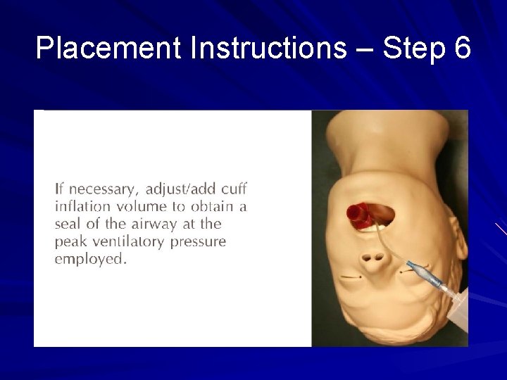 Placement Instructions – Step 6 