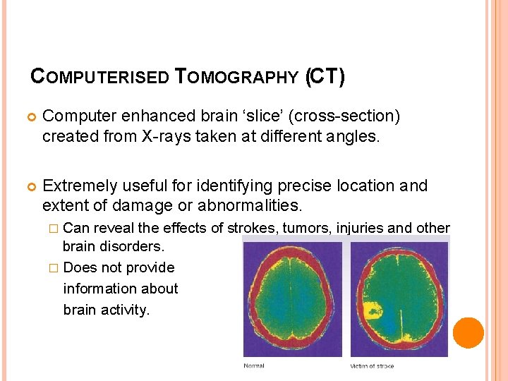 COMPUTERISED TOMOGRAPHY (CT) Computer enhanced brain ‘slice’ (cross-section) created from X-rays taken at different