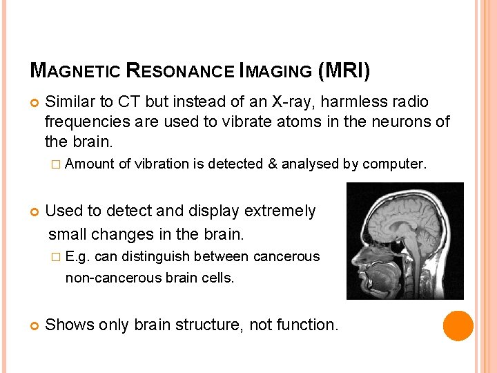 MAGNETIC RESONANCE IMAGING (MRI) Similar to CT but instead of an X-ray, harmless radio