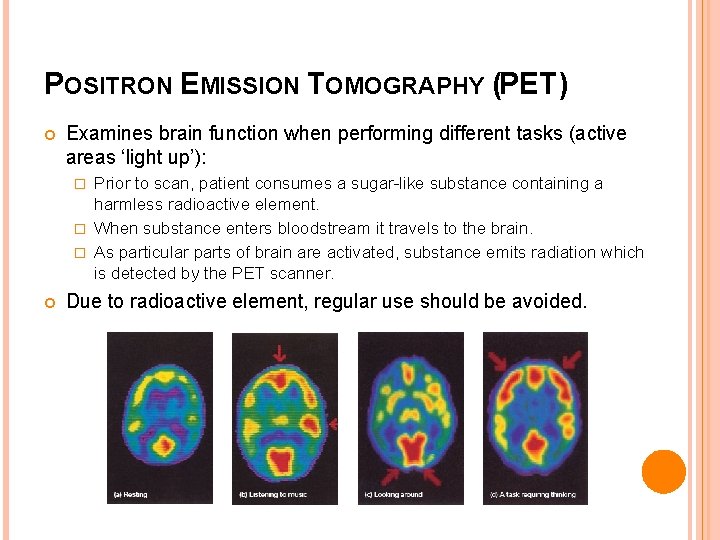 POSITRON EMISSION TOMOGRAPHY (PET) Examines brain function when performing different tasks (active areas ‘light