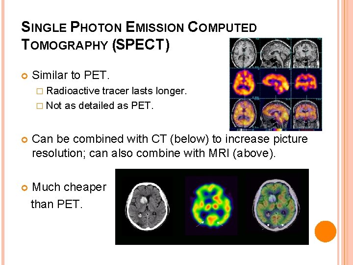 SINGLE PHOTON EMISSION COMPUTED TOMOGRAPHY (SPECT) Similar to PET. � Radioactive tracer lasts longer.