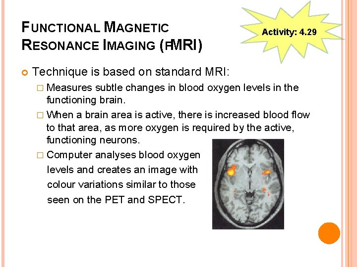 FUNCTIONAL MAGNETIC RESONANCE IMAGING (FMRI) Activity: 4. 29 Technique is based on standard MRI: