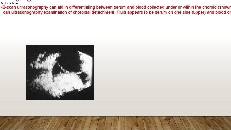 See the list below: • B-scan ultrasonography can aid in differentiating between serum and