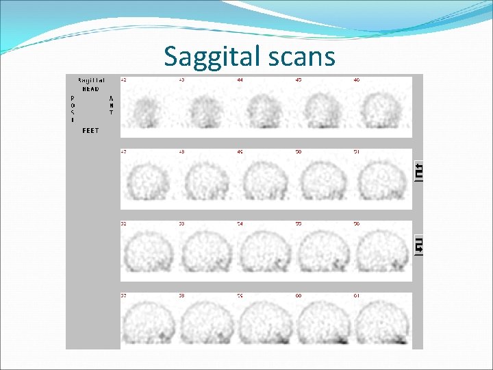 Saggital scans 