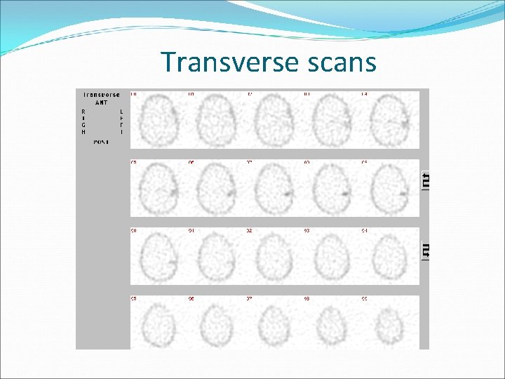 Transverse scans 