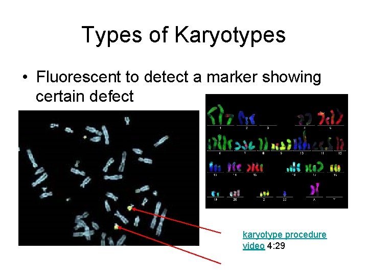 Types of Karyotypes • Fluorescent to detect a marker showing certain defect karyotype procedure