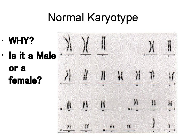 Normal Karyotype • WHY? • Is it a Male or a female? 