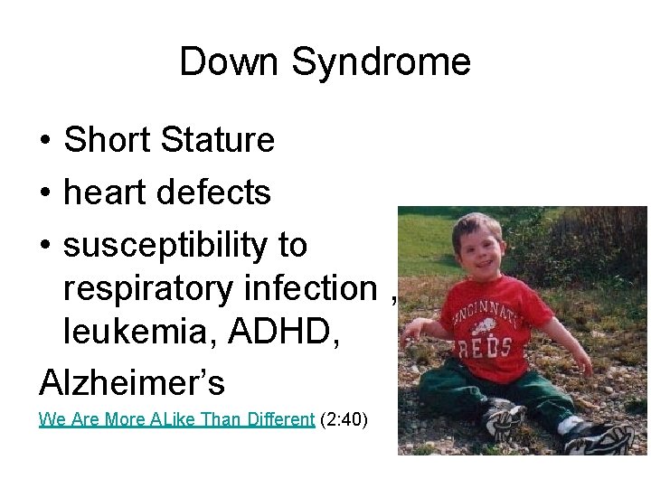 Down Syndrome • Short Stature • heart defects • susceptibility to respiratory infection ,