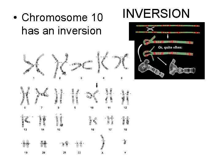  • Chromosome 10 has an inversion INVERSION 