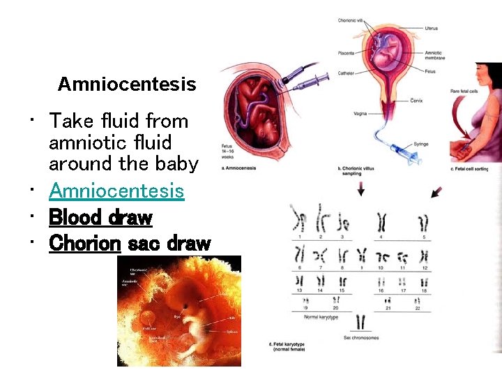 Amniocentesis • Take fluid from amniotic fluid around the baby • Amniocentesis • Blood