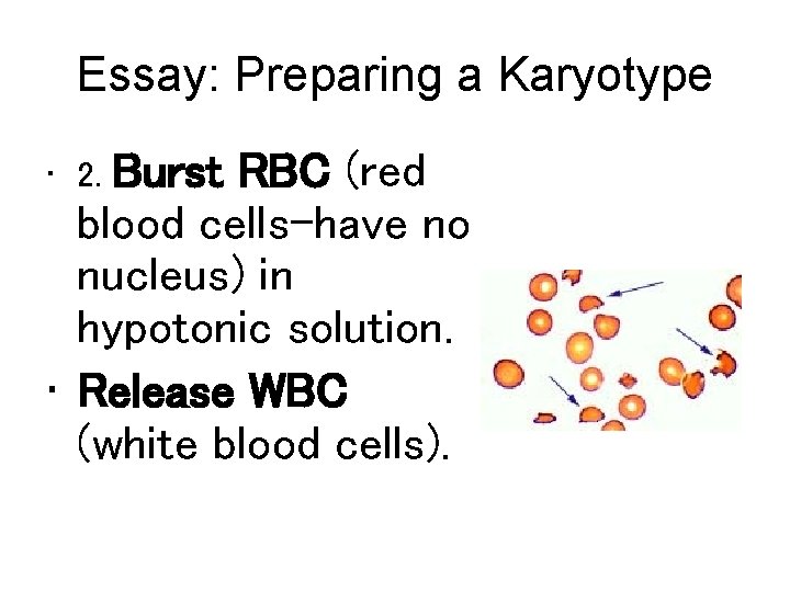 Essay: Preparing a Karyotype Burst RBC (red blood cells-have no nucleus) in hypotonic solution.