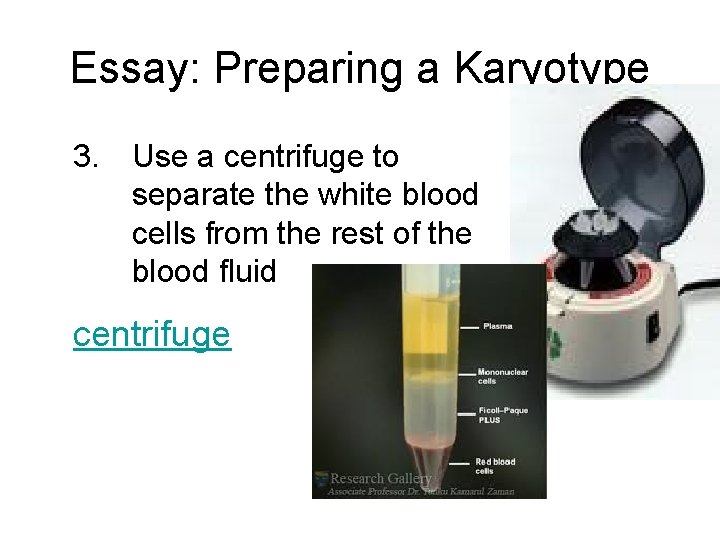 Essay: Preparing a Karyotype 3. Use a centrifuge to separate the white blood cells