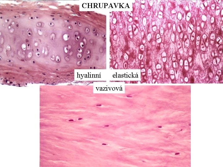 CHRUPAVKA hyalinní elastická vazivová 