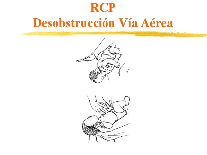 RCP Desobstrucción Vía Aérea 