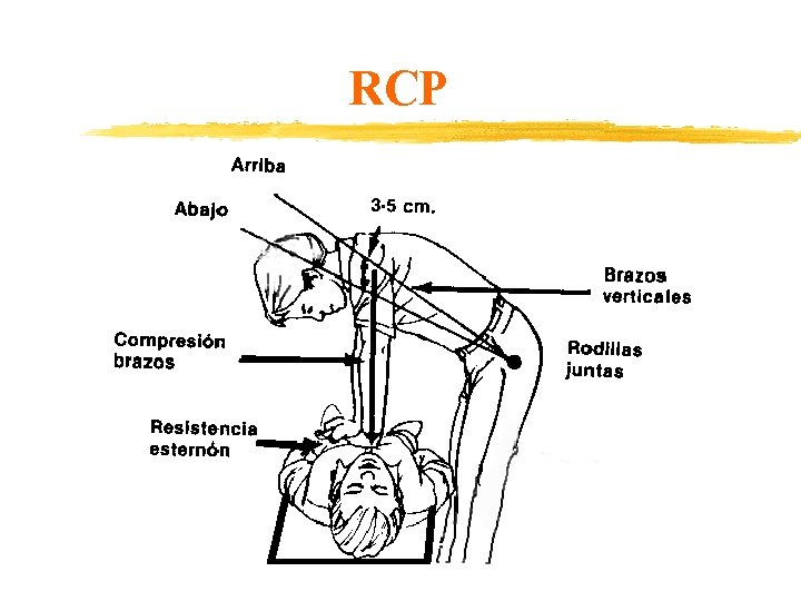 RCP 