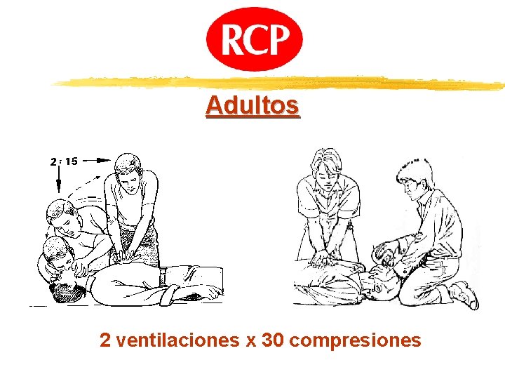 Adultos 2 ventilaciones x 30 compresiones 