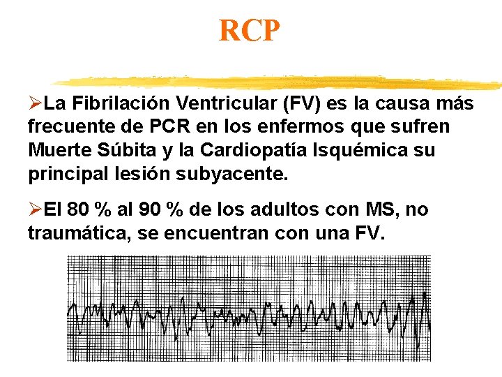 RCP ØLa Fibrilación Ventricular (FV) es la causa más frecuente de PCR en los