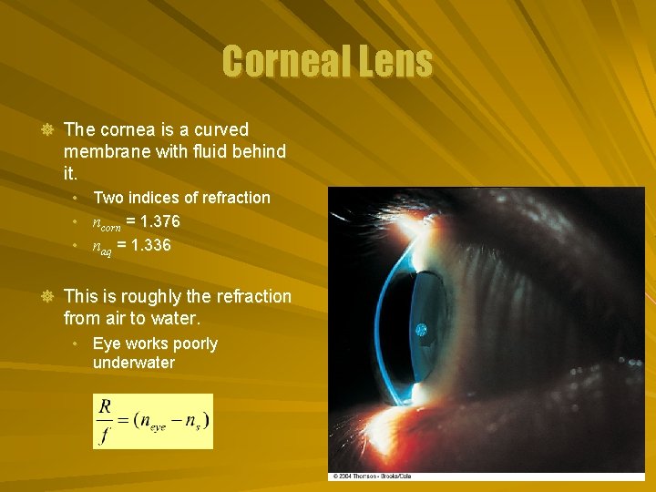 Corneal Lens ] The cornea is a curved membrane with fluid behind it. •